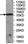 Western blot - Anti-UBASH3A antibody (AB197168)