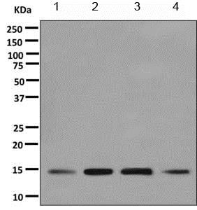Western blot - Anti-UBC4 antibody [EPR11031(B)] (AB155088), expandable thumbnail