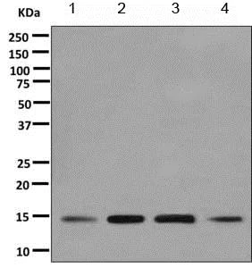 Western blot - Anti-UBC4 antibody [EPR11031(B)] (AB155088)