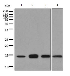 Western blot - Anti-UBC4 antibody [EPR11032(B)] (AB155285)