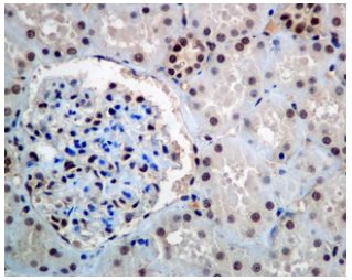 Immunohistochemistry (Formalin/PFA-fixed paraffin-embedded sections) - Anti-Ube2B antibody [EPR7199] (AB128951)