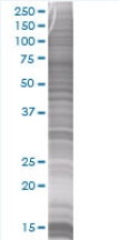 Ube2B overexpression 293T lysate (whole cell)