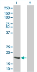 Western blot - Ube2B overexpression 293T lysate (whole cell) (AB94308)