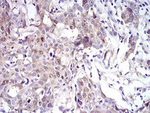 Immunohistochemistry (Formalin/PFA-fixed paraffin-embedded sections) - Anti-UBE2C antibody [1F5D3] (AB201979)