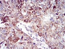 Immunohistochemistry (Formalin/PFA-fixed paraffin-embedded sections) - Anti-UBE2C antibody [1F5D3] (AB201979)