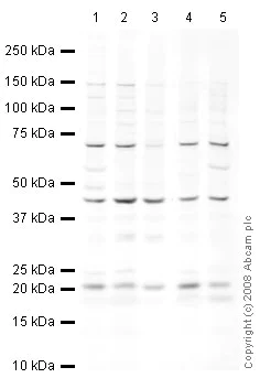 Western blot - Anti-UBE2C antibody (AB12290)