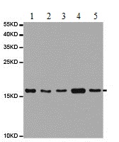 Western blot - Anti-UBE2C antibody (AB187181), expandable thumbnail