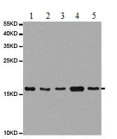 Western blot - Anti-UBE2C antibody (AB187181)