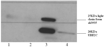 Immunoprecipitation - Anti-UBE2C antibody (AB3935), expandable thumbnail