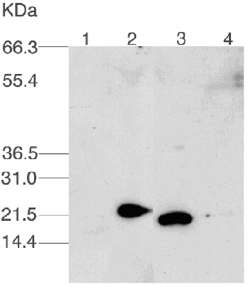 Western blot - Anti-UBE2C antibody (AB3935), expandable thumbnail
