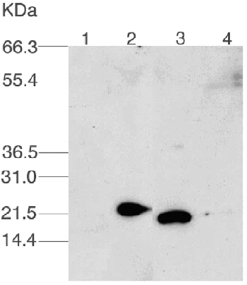Western blot - Anti-UBE2C antibody (AB3935)