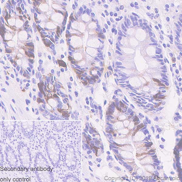 Immunohistochemistry (Formalin/PFA-fixed paraffin-embedded sections) - Anti-UBE2C antibody [EPR23165-31] (ab252940), expandable thumbnail