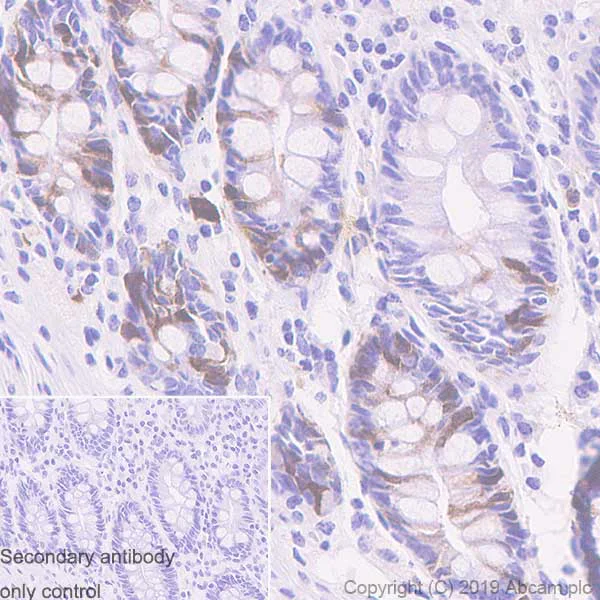 Immunohistochemistry (Formalin/PFA-fixed paraffin-embedded sections) - Anti-UBE2C antibody [EPR23165-31] (AB252940)