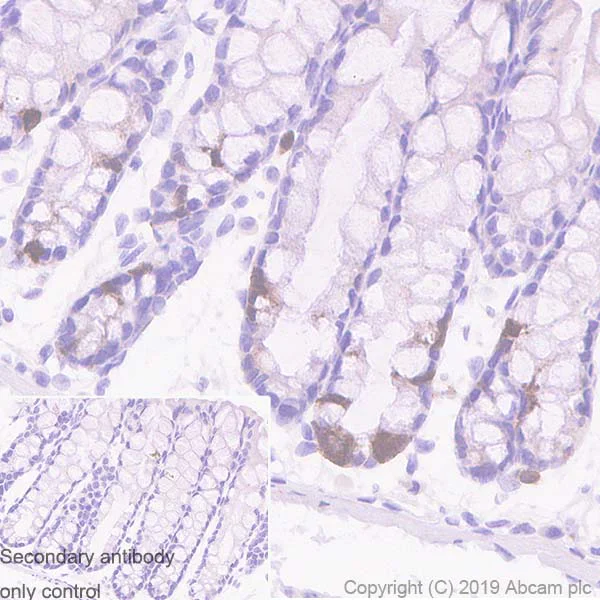 Immunohistochemistry (Formalin/PFA-fixed paraffin-embedded sections) - Anti-UBE2C antibody [EPR23165-31] (AB252940)