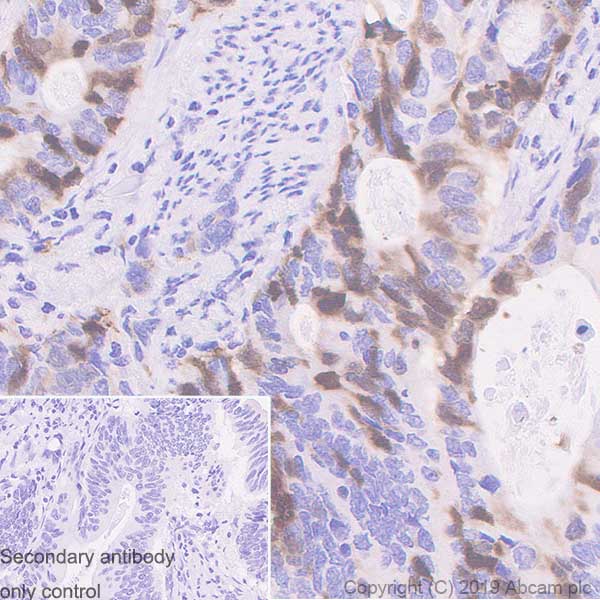 Immunohistochemistry (Formalin/PFA-fixed paraffin-embedded sections) - Anti-UBE2C antibody [EPR23165-31] (AB252940), expandable thumbnail