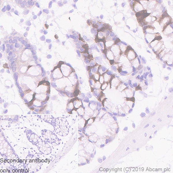 Immunohistochemistry (Formalin/PFA-fixed paraffin-embedded sections) - Anti-UBE2C antibody [EPR23165-31] (ab252940), expandable thumbnail