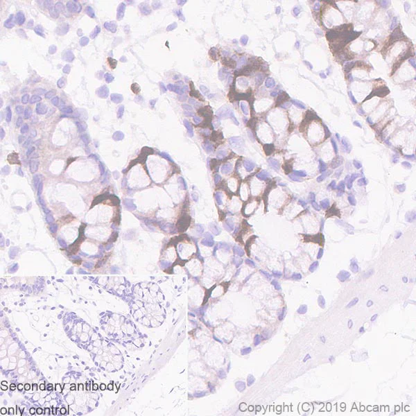 Immunohistochemistry (Formalin/PFA-fixed paraffin-embedded sections) - Anti-UBE2C antibody [EPR23165-31] (AB252940)