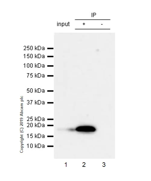 Immunoprecipitation - Anti-UBE2C antibody [EPR23165-31] (AB252940)