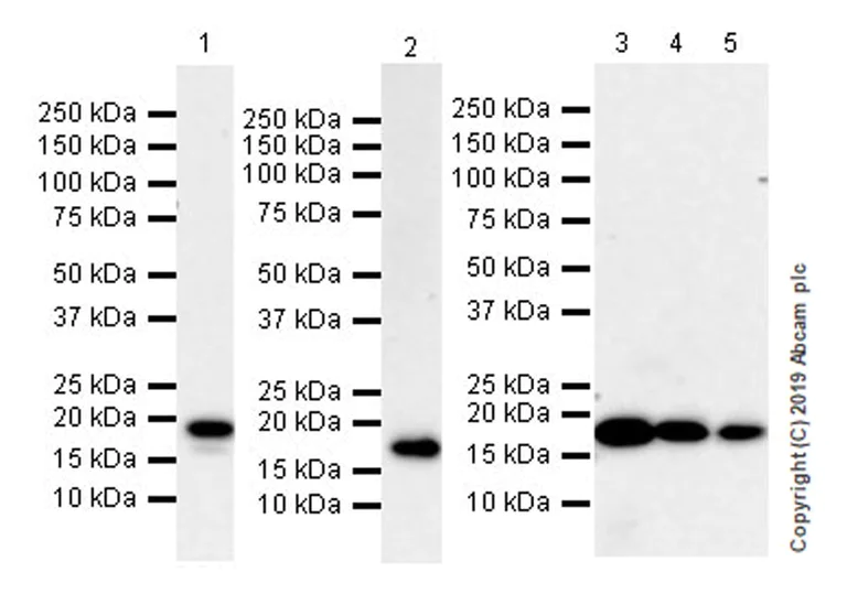 Western blot - Anti-UBE2C antibody [EPR23165-31] (AB252940)