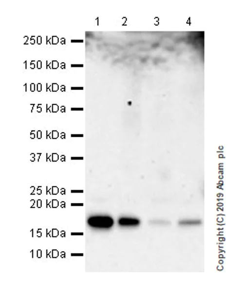 Western blot - Anti-UBE2C antibody [EPR23165-31] (AB252940)