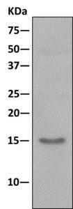 Immunoprecipitation - Anti-UBE2D3 antibody [EPR13001(B)] - BSA and Azide free (AB249927), expandable thumbnail
