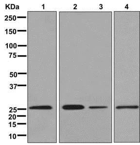 Western blot - Anti-UBE2E2 antibody [EPR13003(B)] (AB177485)