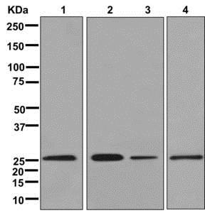 Western blot - Anti-UBE2E2 antibody [EPR13003(B)] - BSA and Azide free (AB249989)