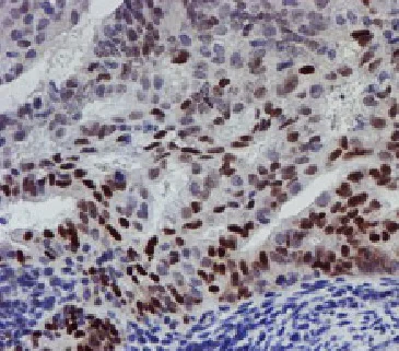 Immunohistochemistry (Formalin/PFA-fixed paraffin-embedded sections) - Anti-UBE2E3 antibody [OTI4B4] (AB128098)