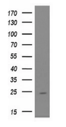 Western blot - Anti-UBE2E3 antibody [OTI4B4] (AB128098)