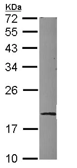 Western blot - Anti-Ube2G1 antibody (AB101371)