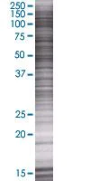 SDS-PAGE - Ube2G1 overexpression 293T lysate (whole cell) (AB94306)