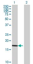 Western blot - Ube2G1 overexpression 293T lysate (whole cell) (AB94306)