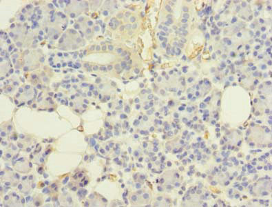 Immunohistochemistry (Formalin/PFA-fixed paraffin-embedded sections) - Anti-Ube2G2 antibody (AB235790)
