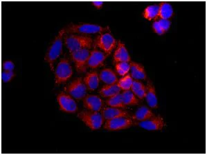 Immunocytochemistry/ Immunofluorescence - Anti-Ube2G2 antibody [EPR9248(2)] (AB174296)