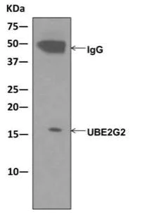 Immunoprecipitation - Anti-Ube2G2 antibody [EPR9248(2)] (AB174296)