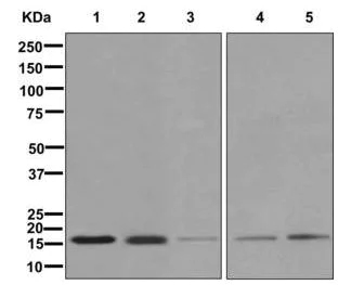 Western blot - Anti-Ube2G2 antibody [EPR9248(2)] (AB174296)