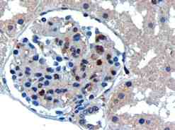 Immunohistochemistry (Formalin/PFA-fixed paraffin-embedded sections) - Anti-UBE2I / UBC9 antibody (AB21193)