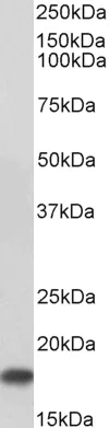 Western blot - Anti-UBE2I / UBC9 antibody (AB21193)