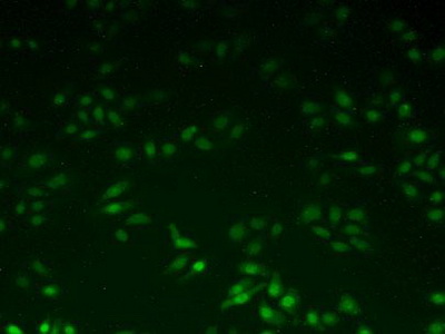 Immunocytochemistry/ Immunofluorescence - Anti-UBE2I / UBC9 antibody (AB233224)