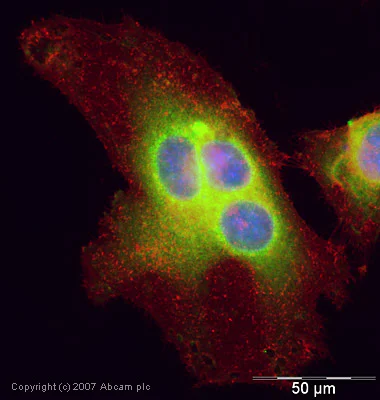 Immunocytochemistry/ Immunofluorescence - Anti-UBE2I / UBC9 antibody (AB33044)