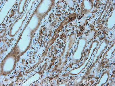 Immunohistochemistry (Formalin/PFA-fixed paraffin-embedded sections) - Anti-UBE2I / UBC9 antibody (AB33044)