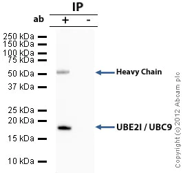 Immunoprecipitation - Anti-UBE2I / UBC9 antibody (AB33044)