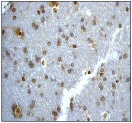Immunohistochemistry (Formalin/PFA-fixed paraffin-embedded sections) - Anti-UBE2I / UBC9 antibody [EP2938Y] (AB75854), expandable thumbnail