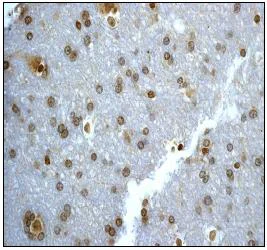 Immunohistochemistry (Formalin/PFA-fixed paraffin-embedded sections) - Anti-UBE2I / UBC9 antibody [EP2938Y] (AB75854)