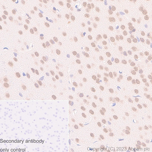 Immunohistochemistry (Formalin/PFA-fixed paraffin-embedded sections) - Anti-UBE2I / UBC9 antibody [EP2938Y] (ab75854), expandable thumbnail