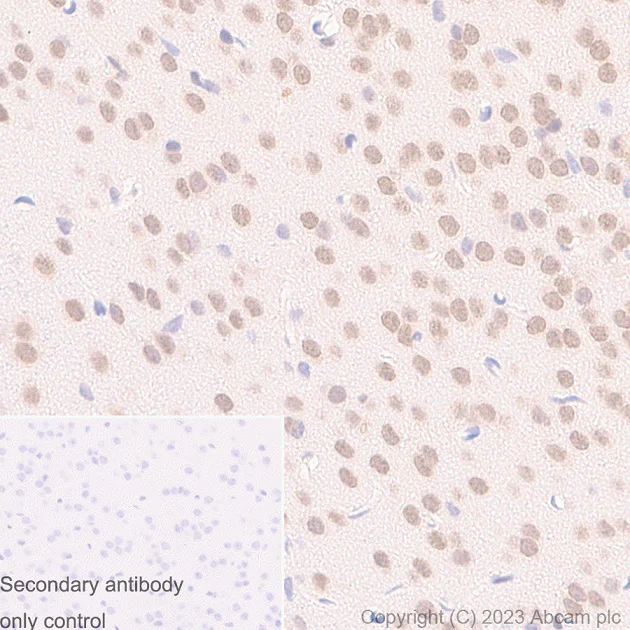 Immunohistochemistry (Formalin/PFA-fixed paraffin-embedded sections) - Anti-UBE2I / UBC9 antibody [EP2938Y] (AB75854)