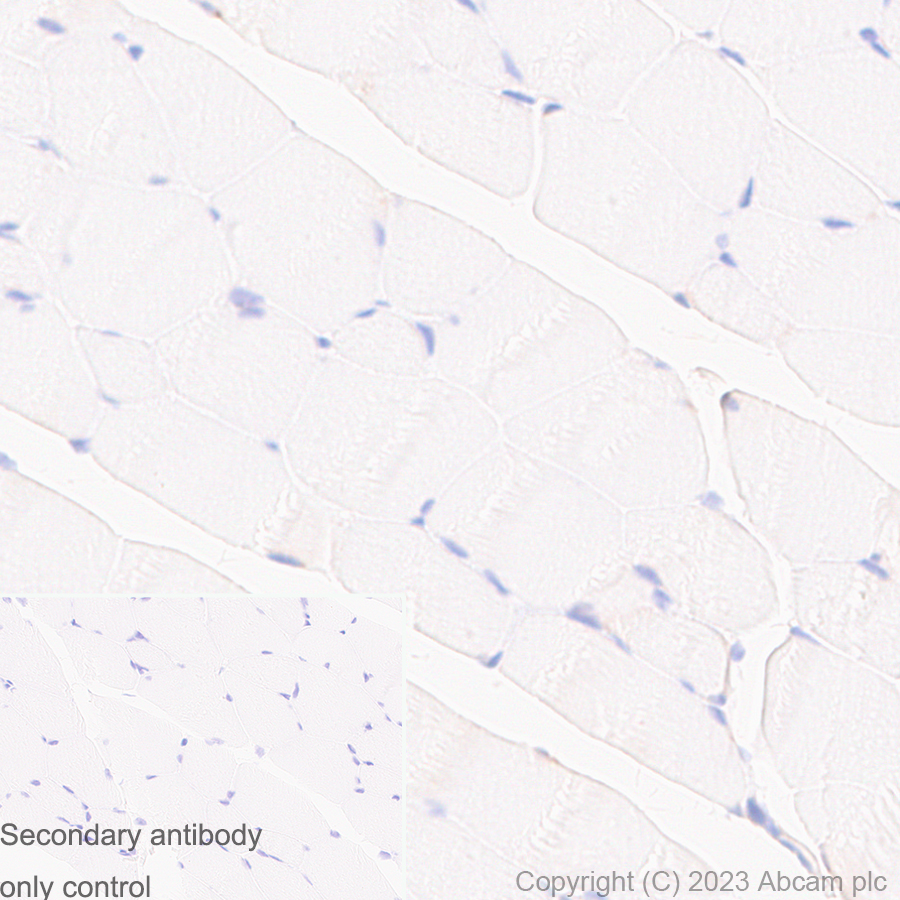 Immunohistochemistry (Formalin/PFA-fixed paraffin-embedded sections) - Anti-UBE2I / UBC9 antibody [EP2938Y] (ab75854), expandable thumbnail