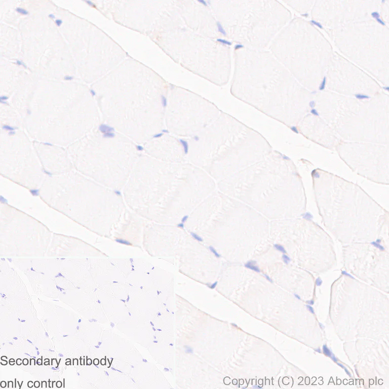 Immunohistochemistry (Formalin/PFA-fixed paraffin-embedded sections) - Anti-UBE2I / UBC9 antibody [EP2938Y] (AB75854)