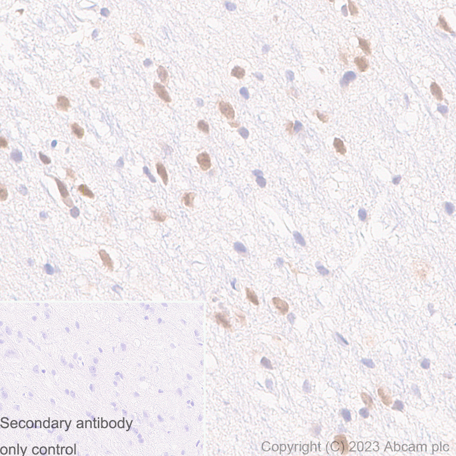 Immunohistochemistry (Formalin/PFA-fixed paraffin-embedded sections) - Anti-UBE2I / UBC9 antibody [EP2938Y] (ab75854), expandable thumbnail