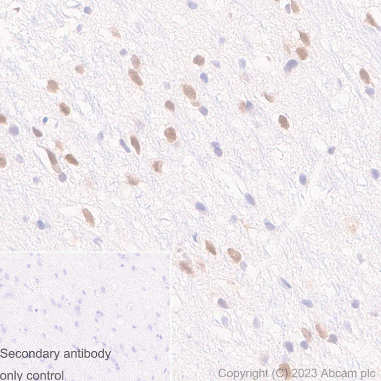 Immunohistochemistry (Formalin/PFA-fixed paraffin-embedded sections) - Anti-UBE2I / UBC9 antibody [EP2938Y] (AB75854)